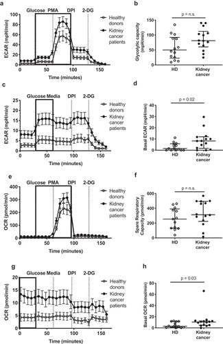 Figure 2. Circulating neutrophils from kidney cancer patients show enhanced metabolic activity. Circulating neutrophils from healthy donors (HD, open symbols) and kidney cancer patients (closed symbols) were plated on Seahorse culture plates in Seahorse media (± glucose and PMA, depending on the condition) and analyzed for maximal (a-b) and basal (c-d) extracellular acidification rate (ECAR), for spare respiratory capacity (e-f) and basal oxygen consumption rate (OCR) (g-h) as determinants of glycolysis and oxidative phosphorylation/NADPH activity, respectively. Glycolytic capacity was defined as the difference between maximal ECAR upon PMA activation and average ECAR upon glucose injection (glycolysis). Differences between kidney cancer patients and healthy donors were determined using the Wilcoxon rank sum test