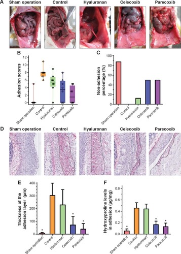 Figure 4 Cyclooxygenase (COX)-2 inhibition attenuates the activated effect of hypoxia on fibroblasts from normal peritoneum.