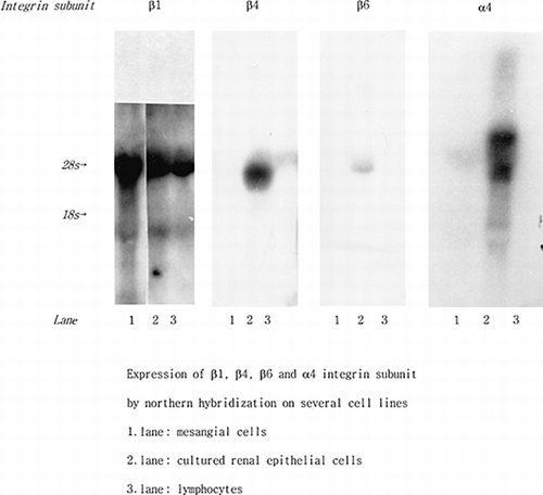 Figure 1. Northern hybridization of cultured cell with α4, β1, β4, β5 and β6 integrin subunit probes. When α4, β1, β4, β5, and β6 integrin subunit m-RNA were evaluated by Northern blotting, there were expected size signals with β1, β4 and β6 c-DNA probes, which suggests that these are epithelial in origin.