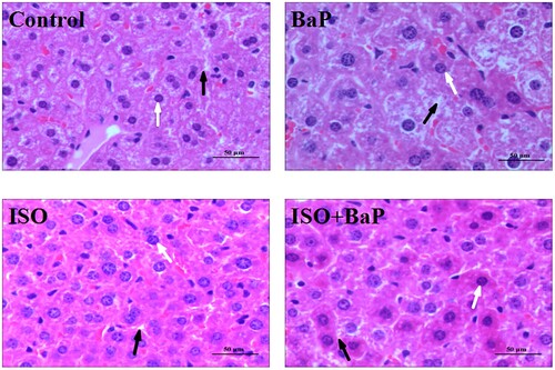 Figure 8. Effects of ISO on the histopathological changes of liver. Histopathology of liver tissue with H&E: hepatocyte nucleus (white arrow) and the interval between cells (black arrow) are shown (Original magnification of 50 μm).