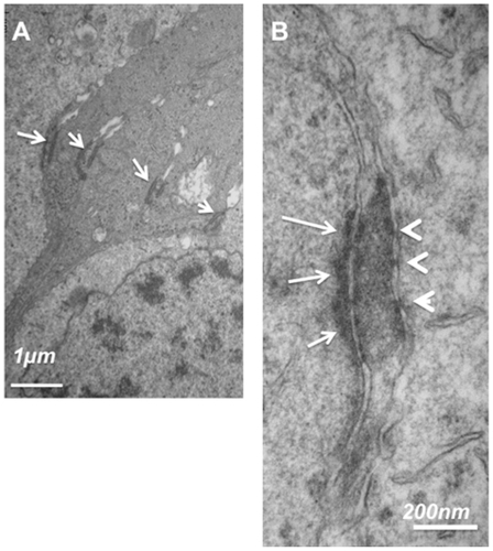 Figure 9 Ultrathin sections of the OLM in the equatorial human retina. (A) junctions at the OLM between glial/glia and glia/photoreceptors. (B) Higher magnification of a heterotypic junction between a Müller glia and a photoreceptor showing asymmetrical disposition of intermediate filaments and tight-like structures (arrowheads).