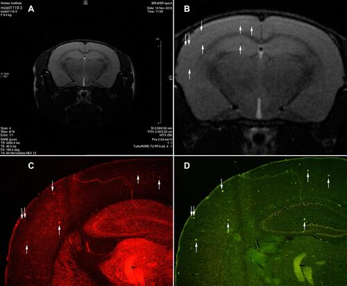 Figure 4 The transgenic mice injected Tat-PTD-USPIO-Aβ(16–20)-HiLyte Fluor 555 were imaged with in vivo MRI to detect Amyloid plaques. It was the T2-weighted image (A) and partial enlarged (B). The red fluorescence referred deposits of the contrast agents in the frozen brain section (C), and the green fluorescence meant the senile plaques stained by Thioflavin-S (D). The match of the red and green fluorescence in one section manifested that the contrast agents could bind to senile plaques in vivo. The distribution of dark spots in the T2-weighted image matched to the distributions of red and green fluorescence, which indicated this MRI contrast agents could bind to the senile plaques of APP/PS1 transgenic mice and also decreased the signal of them. The arrows indicated the contrast agents bounding to the senile plaques in vivo.