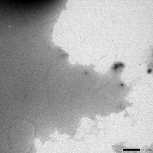 Figure 5. Photomicrograph of the domestic ferret SAA1 peptide taken at low magnification (2000) by transmission electron microscopy. Experimental conditions are identical as in Figure 4.