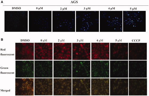 Figure 4. Compound 6 induced apoptosis and mitochondrial depolarisation in AGS cells. (A) AGS cells were treated with Compound 6 (0.0, 2.0, 3.0, 4.0, and 5.0 μM) for 48 h and stained with Hoechst 33258. DMSO was used as negative control. (A) AGS cells were treated with Compound 6 (0.0, 2.0, 3.0, 4.0, and 5.0 μM), CCCP (5.0 μM) and DMSO for 48 h and MMP was determined using the JC-10 kit.