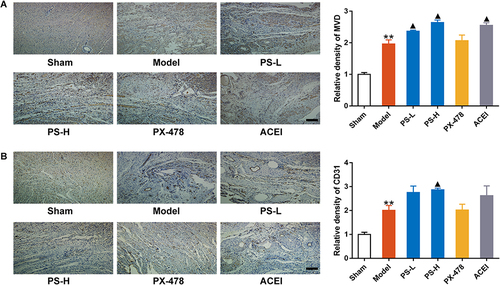 Figure 5 PS promoted the expression levels of MVD and CD31 in the marginal zone of myocardial infarction. (A) The expression of MVD. (B) The expression of CD31. Scale bar = 100 μm, data were expressed as the mean ± SEM, n=3. **P < 0.01, vs sham group; ▲P < 0.05, vs model group.