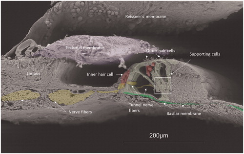 Figure 1. Scanning electron microscopy of the human organ of hearing (organ of Corti). Maximum resolution was to 2 nm. Different structures have been color-labeled for clarity (neurons, yellow; hair cell, red; basilar membrane, green; tectorial membrane, grey; pillar and Deiters cells, light green). Afferent synaptic terminals reach the basal pole of the IHCs. Framed area shows the basal poles where neurons innervate the OHCs. The tunnel nerve fibers are efferents from the medial olivo-cochlear portion innervating the OHCs. Efferents via the lateral olivo-cochlear portion reach the IHC synaptic terminals. Afferent fibers to the OHCs cross the tunnel basally and cannot be seen here. (A different version of this image was published earlier in Anatomical Record [Rask-Andersen et al. 295:1791–1811 (2012)]. Permission for reuse was granted. Permission to reuse Figure 1: License Number 4633510242533; License Date: 21 July 2019; Licensed Content Publisher: John Wiley and Sons; Licensed Content Publication: The Anatomical Record: Advances in Integrative Anatomy and Evolutionary Biology).