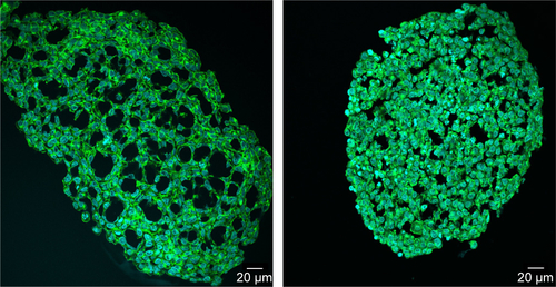 Figure S1 Packing density of HepG2 spheroids at day 3 and 7.Notes: Several HepG2 spheroids were analyzed at day 3 (left) or day 7 (right) after seeding of 1,000 cells per well. In representative confocal fluorescence micrographs the cell membrane (green) and cell nucleus (cyan) are presented. Exemplarily overview images of the whole spheroids are shown.