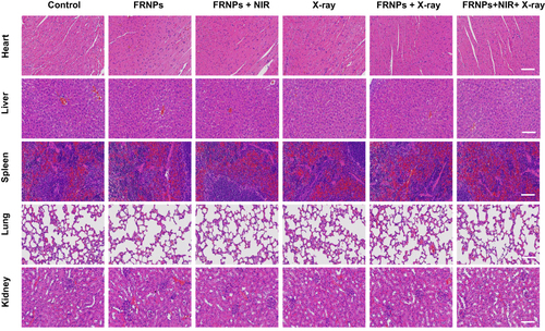 Figure 8 Representative images of H&E staining for main organs of each treatment group (scale bar = 100 μm).