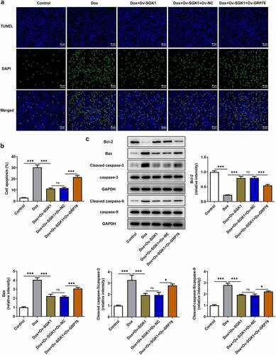 Figure 7. SGK1 overexpression suppressed the apoptosis of doxorubicin-treated H9c2 cells by repressing GRP78-mediated ERS. Doxorubicin-treated H9c2 cells were transfected with Ov-SGK1 or co-transfected with Ov-SGK1 and Ov-GRP78. (a, b) TUNEL staining for determination of the apoptosis of H9c2 cells. (c) Western blot assay for determination of Bcl-2, Bax, Cleaved caspase-3, caspase-3, Cleaved caspase-9 and caspase-9 protein expressions in H9c2 cells. * p < 0.05, *** p < 0.001.