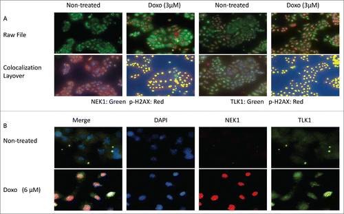 Figure 2. Colocalization of TLK1, NEK1, and γH2AX at sites of DNA damage following incubation with doxorubicin. A. Cells treated with or without doxorubicin (3uM) and then processed for IF as described in.Citation8 Cells were imaged on the Perkin elmer Mantra scope (20x). Raw files were obtained using the InForm. Colocalization layover was applied using InForm software which generates a pseudo pixel (yellow) where the 2 fluors colocalize. Antibodies used were: Rabbit anti-NEK1, Rabbit anti-TLK1, mouse anit γH2AX. B. Microscopy was performed following treatment with doxorubicin. Imaged were obtained at 60X and analyzed with Nikon software. Colocalization of NEK1 and TLK1 is shown in pink.