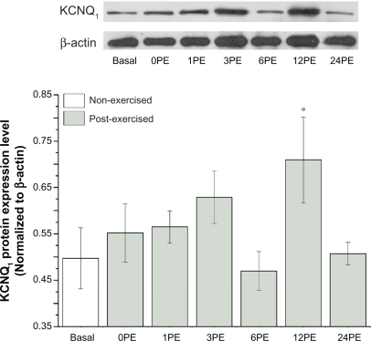 Figure 2 Effect of a single bout of exercise on the expression of KCNQ1 protein.Notes: All values are reported as means ± SE (n = 6). *P < 0.05, the expression level of KCNQ1 at 12PE was significantly different from the basal group.Abbreviation: PE, post exercise.