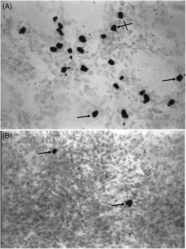 Figure 2. Expression of cellular in renal tissues from HgCl2-treated rats. (a) High numbers of -positive cells are seen in tubules (arrows) and interstitium (cross arrow) of HgCl2 only-treated rats. (b) Losartan treatment diminished the number of -positive cells (arrows) relative to that in HgCl2 only-treated rats. Rats in Groups IV, V and VI presented with normal tissues and so micrographs are not shown. Representative micrographs are presented. Original magnification = 400×.