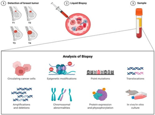 Figure 15. Overview of liquid breast cancer biopsy (Adapted from Hacking SM et al.) [Citation96].