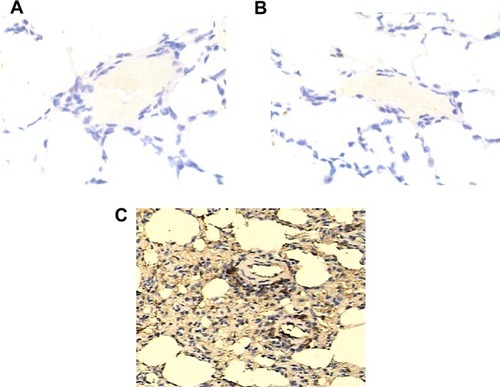 Figure 3 Determination of expression of KRAS in lungs of each genotype group by using immunohistochemistry.Notes: Expression of KRAS was comparable between TT (A), TG (B), and GG (C) groups.