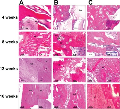Figure 6 Histological evaluation of three groups at 4, 8, 12, and 16 weeks.Notes: (A) BMP2-loaded hollow HA microspheres; (B) hollow HA microspheres without BMP2; (C) soluble BMP2 without a carrier. Scale bars: 400 μm, 10× magnification; 100 μm, 40× magnification.Abbreviations: BC, blood cells; BMP2, bone morphogenetic protein 2; CC, chondrocytes; FT, fibrous tissue; HA, hydroxyapatite; IC, inflammatory cells; Mat, material; NB, new bone; NLB, new lamellar bone; OB, osteoblasts; OC, osteocytes; OT, osteon; V, vessel.