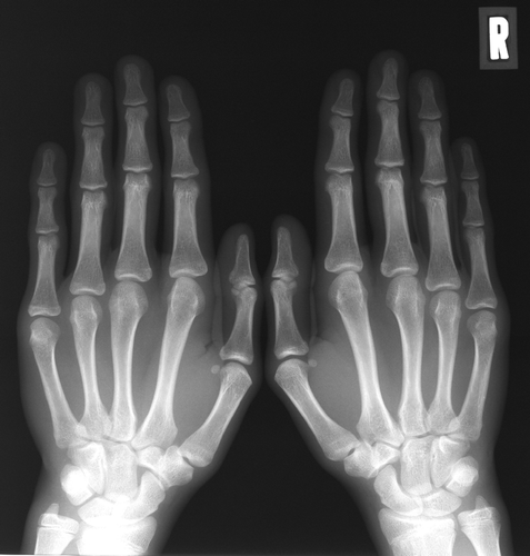 Figure 2.  View of the XP photograph of the hand. No abnormalities are evident.