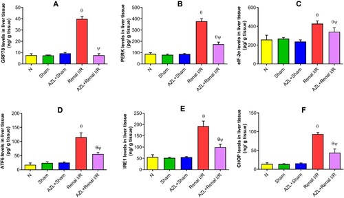 Figure 3. The effect of azilsartan (AZL, 3 mg/kg/day, PO for 7 days) on endoplasmic reticulum (ER) stress markers in liver tissue of sham and renal ischemic (I/R) rats. Each bar represents the mean ± SD of six rats per group; ϴp < 0.01 vs. NC and sham control groups; ΨP < 0.001 vs. Renal I/R group. GRP78: glucose-regulated protein 78 kDa; PERK: protein kinase RNA–like endoplasmic reticulum kinase; ATF6: activating transcription factor 6; IRE1: inositol requiring enzyme 1; eIF2α: eukaryotic initiation factor 2 alpha; CHOP: C/EBP homologous protein.