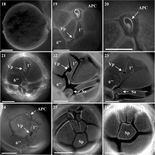 Figs 18–26. Alexandrium ostenfeldii from Scottish waters, identified using light microscopy with epifluorescence. Fig. 18. General cell shape. Fig. 19. Epithecal plates showing clear contact between APC and 1′, with large ventral pore and wide 6′′. Fig. 20. Apical view of APC. Fig. 21. Ventral view showing 1′ with large ventral pore and wide 6′′. Figs 22, 23. 1′ with large ventral pore, Sa plate and partial view of 6′′. Fig. 24. Epithecal plates showing APC 1′ and wide 6′′. Figs 25, 26. Antapical view showing Sp with no Pap. Scale bars represent: 10 µm.