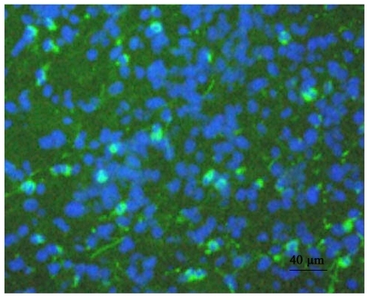 Figure 6 Rabbit CCA results demonstrating cells expressing GFP mediated by pEGFP-C1-loaded NP stents in vivo.