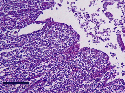 Figure 1.  Histologic section of duck caeca, examined 35 days p.i. with H. meleagridis. Note histomonads within the mucosa. Periodic acid Schiff reagent, bar = 100 µm.