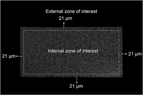 Figure 7 Reconstructed image of dentin and different zones of interest.