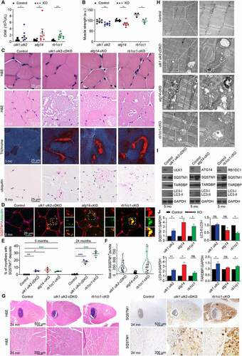 Figure 2. Loss of Atg14 and Rb1cc1 causes skeletal vacuolar myopathy. (A) Serum M-type (CKM/creatine kinase) levels of control, ulk1 ulk2-cDKO, atg14-cKO, and rb1cc1-cKO mice at 2 months. *P < 0.05, **P < 0.01, ***P < 0.001 by Student’s t-test. All quantitative data are presented as mean ± SEM. (B) Muscle strength of control, ulk1 ulk2-cDKO, atg14-cKO, and rb1cc1-cKO mice at the age of 8 months. *P < 0.05, **P < 0.01, ns: not significant by Student’s t-test. All quantitative data are presented as mean ± SEM arbitrary units (a.u.). (C) Muscle cross sections of control, ulk1 ulk2-cDKO, atg14-cKO, and rb1cc1-cKO mice were stained with H&E, modified Gomori trichrome, and an anti-ubiquitin antibody. (D) Immunostaining of quadriceps in 5-month-old mice showing accumulation of SQSTM1, which colocalized with ubiquitin in ulk1 ulk2-cDKO, atg14-cKO, and rb1cc1-cKO mice. (E) Percentages of myofibers from quadriceps with SQSTM1+ deposits were quantified from 5- and 24-month-old control, ulk1 ulk2-cDKO, atg14-cKO, and rb1cc1-cKO mice. *P < 0.05, **P < 0.01, ***P < 0.001 by Student’s t-test. All quantitative data are presented as mean ± SEM, n = 3 for each genotype. (F) Size distribution of SQSTM1+ deposits observed in the 5-month-old control, ulk1 ulk2-cDKO, atg14-cKO, and rb1cc1-cKO mice. n = 3 for each genotype. (G) Muscle cross sections of 24-month-old control, ulk1 ulk2-cDKO, and rb1cc1-cKO mice stained with H&E and anti-SQSTM1 antibodies. (H) Ultrastructural studies of quadriceps from 5-month-old control, ulk1 ulk2-cDKO, atg14-cKO, and rb1cc1-cKO mice. (I) Protein extracts prepared from quadriceps of 5-month-old control, ulk1 ulk2-cDKO, atg14-cKO, and rb1cc1-cKO mice and analyzed by immunoblot against SQSTM1, LC3B, TARDBP, and GAPDH. (J) Fold-change in protein levels of SQSTM1, LC3-II, LC3-II, LC3-I and TARDBP in 5-month-old ulk1 ulk2-cDKO, atg14-cKO, and rb1cc1-cKO mice compared to the corresponding control, as determined by densitometry. n = 3 for each genotype. ns, not significant; *P < 0.05 and **P< 0.01 by Student’s t-test. Note: In (A), (E), and (F), data for ulk1 ulk2-cDKO mice and littermate controls were previously reported17 and replotted to facilitate direct comparison