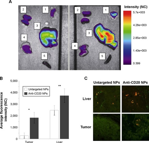 Figure 5 Ex vivo analysis.Notes: (A) Ex vivo optical imaging of organs explanted at 168 hours after Cy5.5-untargeted NPs or Cy5.5-anti-CD20 NPs administration are shown – 1: tumor mass; 2: kidney; 3: liver; 4: lung; 5: spleen. (B) Histogram representation of the average fluorescence intensity (NC) over tumor and liver tissues explanted at 168 hours after NP administration. *Difference 84%, P-value =0.0069; **difference 34%, P-value =0.0056. Data are expressed as means ± standard deviation of three independent experiments. (C) Confocal microscopy images of explanted tumor mass’ and liver’s cryosections obtained from Cy5.5-untargeted NP and Cy5.5-anti-CD20 NP injections into mice. Tissue sections were also photographed through a green filter (FITC) to visualize background autofluorescence. Original magnification 600×.Abbreviations: FITC, fluorescein isothiocyanate; NC, normalized counts; NP, nanoparticle.