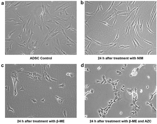 Figure 2. Morphological characterization of ADSCs and ADSCs after pre-induction. ADSCs expressed classic spindle-shaped fibroblastic structure of mesenchymal stem cells (a) ADSCs at 24 h after induction with only NIM exhibit sharply curved structures (b) ADSCs at 24 h after pre-induction with β-ME display cell shrinkage and clumping (c) ADSCs at 24 h after pre-induction with β-ME and 5-azacytidine (AZC) display more shrinkage, clumping, and micro-projections (d). (Magnification 10 x).