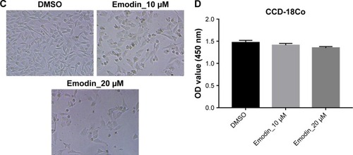 Figure 1 Emodin suppressed the proliferation of fibroblasts obtained from patients with AS.