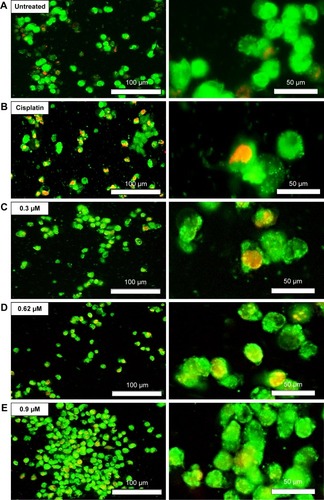 Figure 4 Images of AO/PI staining of A2780 cells.
