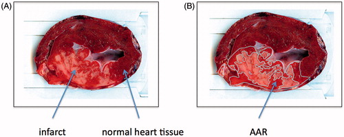 Figure 2. (A) Representative heart slice after staining with Evans Blue (Sigma-Aldrich) and 2,3,5-triphenyltetrazodiumchloride TTC (Sigma-Aldrich). Yellow-white areas indicate infarct, bright red areas indicate AAR and purple areas indicate normal heart tissue (see arrows for explanation). (B) Heart slice after the areas have been drawn.