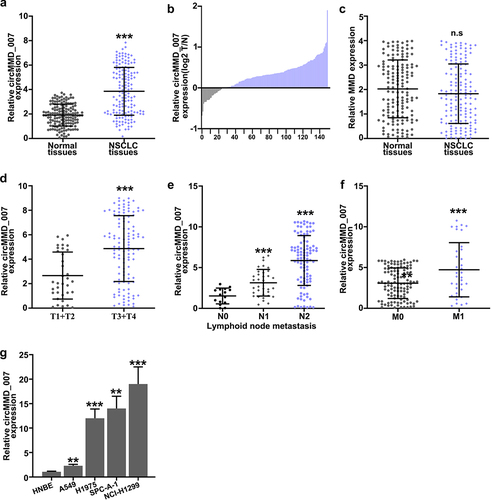 Figure 2. Hsa_circMMD_007 was abnormally increased in lung adenocarcinoma A, B: circMMD_007 was examined in lung adenocarcinoma and normal tissues by qRT-PCR. As compared with the normal tissues, hsa_cirMMD_007 expression was higher in NSCLC tissues. C: MMD was examined in lung adenocarcinoma and normal tissues. D: circMMD_007 expression was observed to be higher in (T3+ T4) lung adenocarcinoma tissues, as compared to (T1+ T2) lung adenocarcinoma tissues (p < 0.001). E: The expression was higher in N2 and N1, compared with N0. (p < 0.001). F: Expression was higher in the M1 stage, compared with M0 stage (p < 0.001). G: The expression of circMMD_007 was higher in NCI-H1299, NCI-H1395, A549, NCL-H460 cells, compared with HNBE cells (p < 0.01).