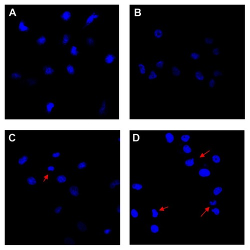 Figure 5 Changes in nuclear morphology of DDP-resistant A549 cells after treatment for 48 hours (DAPI staining, ×400). (A) Control, (B) 25 μg/mL Fe3O4-MNP, (C) 20 μmol/L DDP, and (D) Fe3O4-MNP-DDP.Notes: The red arrows indicate the apparent apoptotic cells with incomplete nuclear.Abbreviations: Fe3O4-MNP, magnetic Fe3O4 nanoparticles; DDP, cisplatin; DAPI, fluorechrome dye 4, 6-diamidino-2-phenylindole.