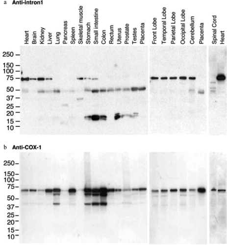 Figure 2. Tissue distribution of intron-1 retaining COX-1 proteins with 55 and 75KDa molecular weights in human tissues. Human multiple tissue total protein blots were probed with antihuman COX-1 intron 1 antibody (a) and re-probed with anti-human COX-1 antibody (b) using Western blotting analysis. Reproduced from Qin et al. 2005 [Citation43]