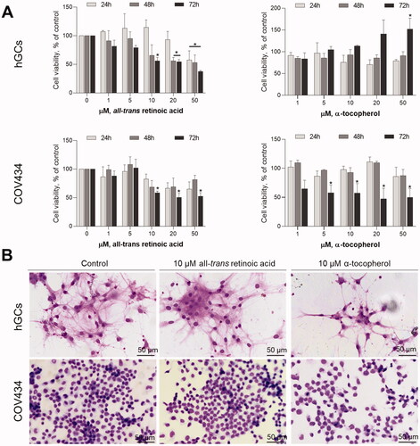 Figure 2. Effects of atRA and alpha-tocopherol on granulosa cell viability and morphology. (A) In both hGCs and COV434 cells, atRA induced a significant decrease in granulosa cell viability after 24 h, 48 h or 72 h post-treatment assessed by MTT assay. The effects of alpha-tocopherol on the reduction of granulosa cell viability were more pronounced in COV434 cells. (B) The atRA at 10 µM or alpha-tocopherol at 10 µM did not affect per se cell density nor morphology assessed by Giemsa staining after 72 h. Graphs are representative of three independent assays with three replicates for each concentration of the compounds. Data are presented as mean ± SEM (*p < 0.05 compared to respective untreated control; one-way ANOVA with Tukey’s ad hoc post-test).