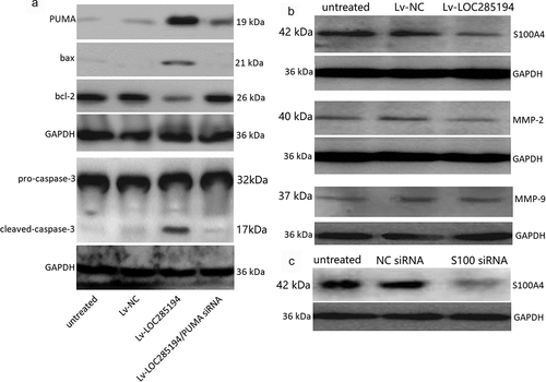 Figure 3. Effect of LOC285194 overexpression on apoptotic and metastatic protein expression in vitro.