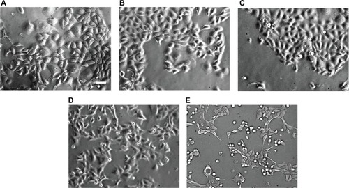 Figure 1 Phase-contrast micrographs of triptolide-treated MCF-7 cells incubated for 24 hours.
