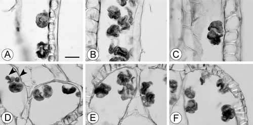 Figure 7. A–F. Light micrographs of tetrads and loose pollen grains in cross‐sections of anthers of Trithuria inconspicua, the perennial New Zealand species. (A) Loose “normal” pollen grain with aperture visible (in the upper part of the figure) and a tetrad of collapsed grains (in the lower side of the figure); (B–F) tetrads of mostly collapsed pollen grains; micrograins (arrowheads) are visible in (D). Scale bar common to all images – 20 µm.