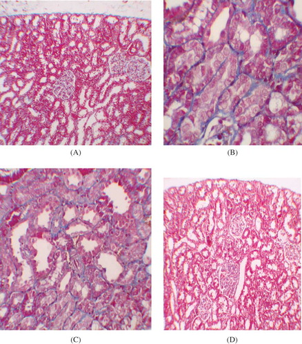 Figure 2.  (A) No fibrosis in the control group, staining with Masson’s trichrome ×100. (B) Mild fibrosis in interstitium, staining with Masson’s trichrome ×400 (GEN-treated group). (C) Mild fibrosis in interstitium, staining with Masson’s trichrome ×200 (GEN + vehicle-treated group). (D) No fibrosis in GEN + PE-treated group, staining with Masson’s trichrome ×100.