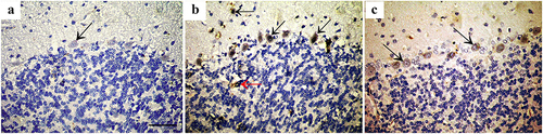 Figure 5. Immunohistochemically stained cerebellar sections for Bax protein showing (a): Negative expression in control group (arrow). (b): Intense expression in Purkinje cells and basket cells (arrow) and some granule cells (red arrow) of group II, while (c): shows weak expression in Purkinje cells of group III (arrow). (Anti Bax×400; Scale bar = 30 µm).