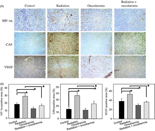 Figure 6. (A) Immunohistological staining for HIF-1α, CA9 and VEGF in FSaII tumours three days after treatment. Radiation: Tumours were irradiated with 15 Gy. Oncothermia: Tumours were heated once at 41 °C for 30 min. Radiation + Oncothermia: Tumours were irradiated with 15 Gy and heated once at 41 °C for 30 min (B). Expression of HIF-1α, VEGF and CA9 was quantified using Image J 1.38× software (Rasband, W.S., Image J, US National Institutes of Health, Bethesda, MD). Ten images were captured for each of the three tissue sections per tumour and % positive areas calculated. Means of 4–6 tumours ±1 SE are shown. *indicates p < 0.05.