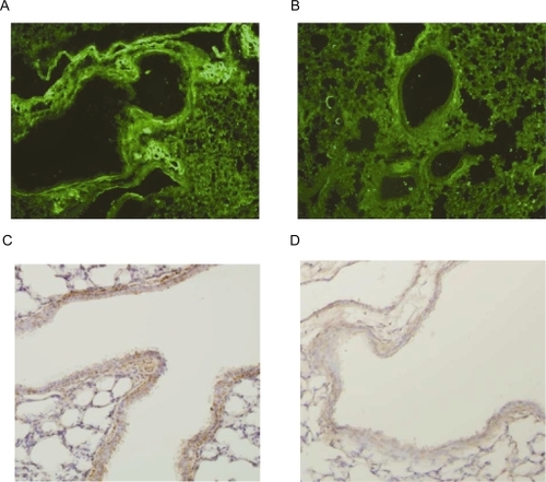 Figure 5 RSV-NPs detection of RSV-infected lung tissue. Lung tissue sections from RSV-infected (A, C) or naïve, mock-treated BALB/c mice (B, D) were stained by IHC using RSV-NPs (A, B), or by conventional IHC (C, D), and analyzed using an immunofluorescence microscopy.Abbreviations: IHC, immunohistochemistry; RSV-NP, respiratory syncytial virus-nanoparticles.