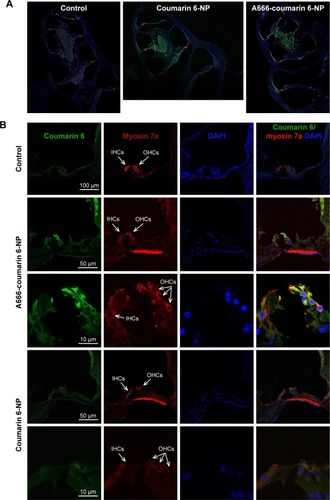 Figure 6 In vivo OHCs targeting of coumarin 6-labeled A666-NP (A666-coumarin 6-NP).Notes: Three guinea pigs in each group were treated with coumarin 6-NP (green) with or without A666 decoration on round window membrane by a single dose. After 2 h, the animals were sacrificed, and the inner ear was harvested, fixed, and sectioned. The cochleae were immunostained for myosin 7a (OHCs) (red). (A) Whole inner ear of guinea pigs treated with A666-coumarin 6-NP or coumarin 6-NP. (B) The organ of Corti treated with A666-coumarin 6-NP or coumarin 6-NP. Most A666-coumarin 6-NP accumulate on OHC, while coumarin 6-NP showed no OHC targeting.Abbreviations: IHC, inner hair cell; NP, nanoparticle; OHC, outer hair cell.