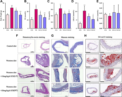 Figure 1 Sodium tanshinone IIA sulfonate alleviates atherosclerosis in ApoE−/− mice. (A) Body Weight, (B) plasma total cholesterol (TC) level, (C) plasma triglyceride (TG) level, (D) Plasma low-density lipoprotein cholesterol (LDL-c) level, and (E) plasma high density liptein cholesterol (HDL-c) level. (F) H&E staining of the aortic arches of the ApoE−/− mice. (G) Masson staining of the aortic arches. (H) Oil red O staining of the aortic arches. Data are represented as mean ± SD of three independent replicates; **P < 0.01 vs NCD group; †P < 0.05, ††P < 0.01 vs AS model group.