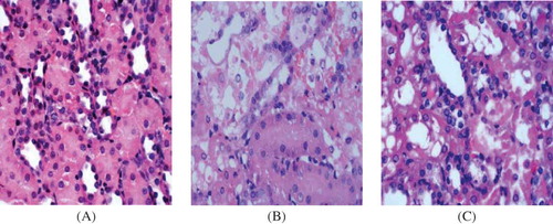 Figure 1. Hematoxylin–eosin staining in tissue samples. (×400). (A) Control group at day 7. There was no significant histological abnormality in the control group. (B) Model group at day 7. Severe epithelial degeneration, necrosis, and collapse were observed in most of the renal tubular epithelial cells, and some renal tubular epithelial cells had only the residual basement membrane. (C) PGE1 group at day 7. Only local tubular epithelial shedding and protein casts were observed, and mild glomerular lesions and proliferation of mesangial matrix were observed.