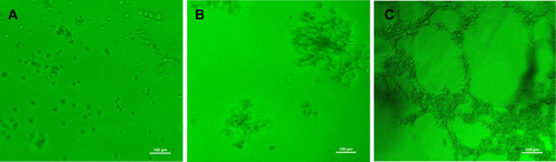 Figure 8 Transplantation of MSCs enhanced endothelial differentiation of endogenous MSCs. Blood samples were collected from normal (A), PBS- (B) and MSC-treated (C) broiler chickens at 3 weeks post transplantation. Cells at Passage 1 were suspended in DEME and seeded in 96-well plates pre-coated with Matrigel matrix at 5 × 104/well with triplicate. Tubular-like structures were observed udder phase-contrast microscopy within 4 h of incubation.