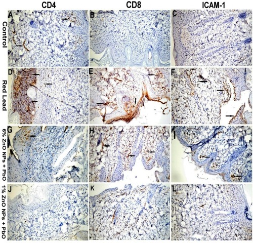 Figure 4 Immunohistochemical staining of the skin tissue sections showing mild to negative CD4, CD8 and ICAM-1 gene expression among the skin tissues in control groups (A, B, C). A marked increase in a number of cells expressed CD4, CD8 and ICAM-1 among dermal and epidermal layers observed in the group received lead oxide (D, E, F). Moderate reactions of the above gene expression among the skin tissue sections in 6%ZnO NPs pretreated rats (G, H, I). Mild to negative gene expression among the skin tissues in 1%ZnO NPs pretreated rats (J, K, L) (IHC X200 for all figs).