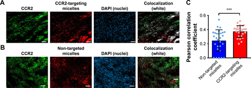 Figure S2 Colocalization studies of DiD-labeled (A) CCR2-targeting micelles and (B) non-targeted micelles with CCR2-labeled inflammatory cells in the infarcted myocardium. The colocalization of CCR2-positive cells and DiD-labeled micelles is shown in white. (C) The PCC was used to quantify the degree of colocalization between CCR2-positive inflammatory cells and the DiD-labeled CCR2-targeting and non-targeted micelles.Notes: A PCC of 1 indicates perfect correlation, a PCC of 0 means no correlation, and a PCC of −1 means perfect inverse correlation. The CCR2-targeting micelles showed a significantly greater colocalization with CCR2-positive cells than non-targeted micelles (P=0.0004). Three days after inducing myocardial infarction, mice were treated with DiD-labeled CCR2-targeting (n=3) and non-targeted micelles (n=3). 6 hours post administration, the hearts were removed and embedded in Tissue-Tek O.C.T. Frozen heart sections with 10 μm thickness were fixed and permeabilized with ice-cold acetone, and blocked with 5% bovine serum albumin in TBST. The sections were stained with an anti-mouse CCR2 antibody (Thermo Fisher Scientific, PA5-23043) at a 1:50 dilution for 1 hour at room temperature, followed by 45 minutes incubation with a secondary antibody labeled with Alexa Fluor 568 at 1:200 dilution. The nuclei were stained with DAPI. The analysis was performed in ImageJ using the Coloc 2 function. On average, three cryosections per heart were analyzed. For each cryosection, three representative images were taken. Data are presented as mean ± SD. A two-tailed t-test was used to determine statistical significance (P=0.0004). ***P≤0.001.Abbreviation: PCC, Pearson correlation coefficient.