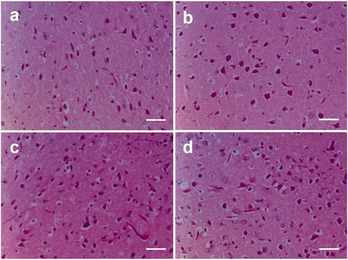 Figure 2. Effects of D-penicillamine and lasiodiplodan on cerebral cortex histology of rats (100x). (a) cerebral cortex from the Ct group; (b) cerebral cortex from the Las group; (c) cerebral cortex from the D-Pen group; (d) cerebral cortex from Las + D-Pen group. Scale bar 25 μm.