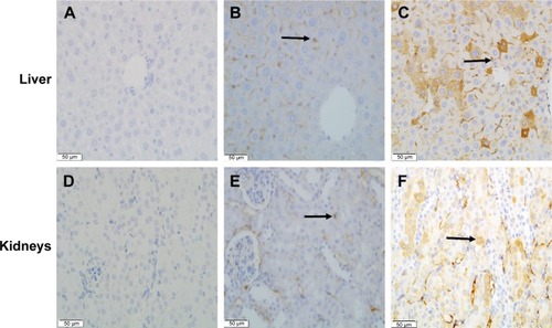 Figure 4 Immunohistochemistry with a specific antibody.Notes: Against metallothionein in the liver (A–C) and kidneys (D–F). There were a few positive cells (brown staining) in the control groups (B, E). The number of positive cells was increased in the exposed groups (C, F). Negative controls for the immunostaining were achieved by replacing the antimetallothionein with phosphate-buffered saline (A, D). Arrows indicate positive immunoreactions. Immunohistochemical labeling was performed using horseradish peroxidase–streptavidin detection with hematoxylin and eosin counterstaining. Final magnification 400×, scale bars 50 µm.